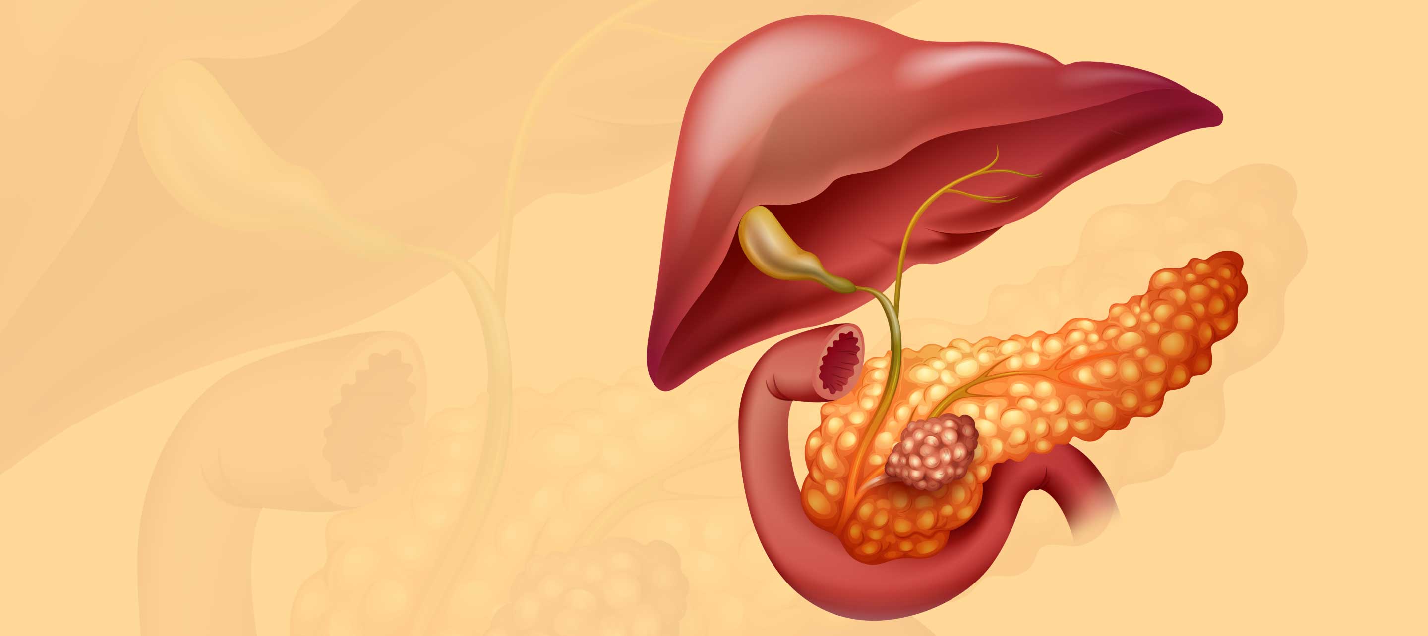 Bile Duct Cancer Surgery Cost in Pune, India