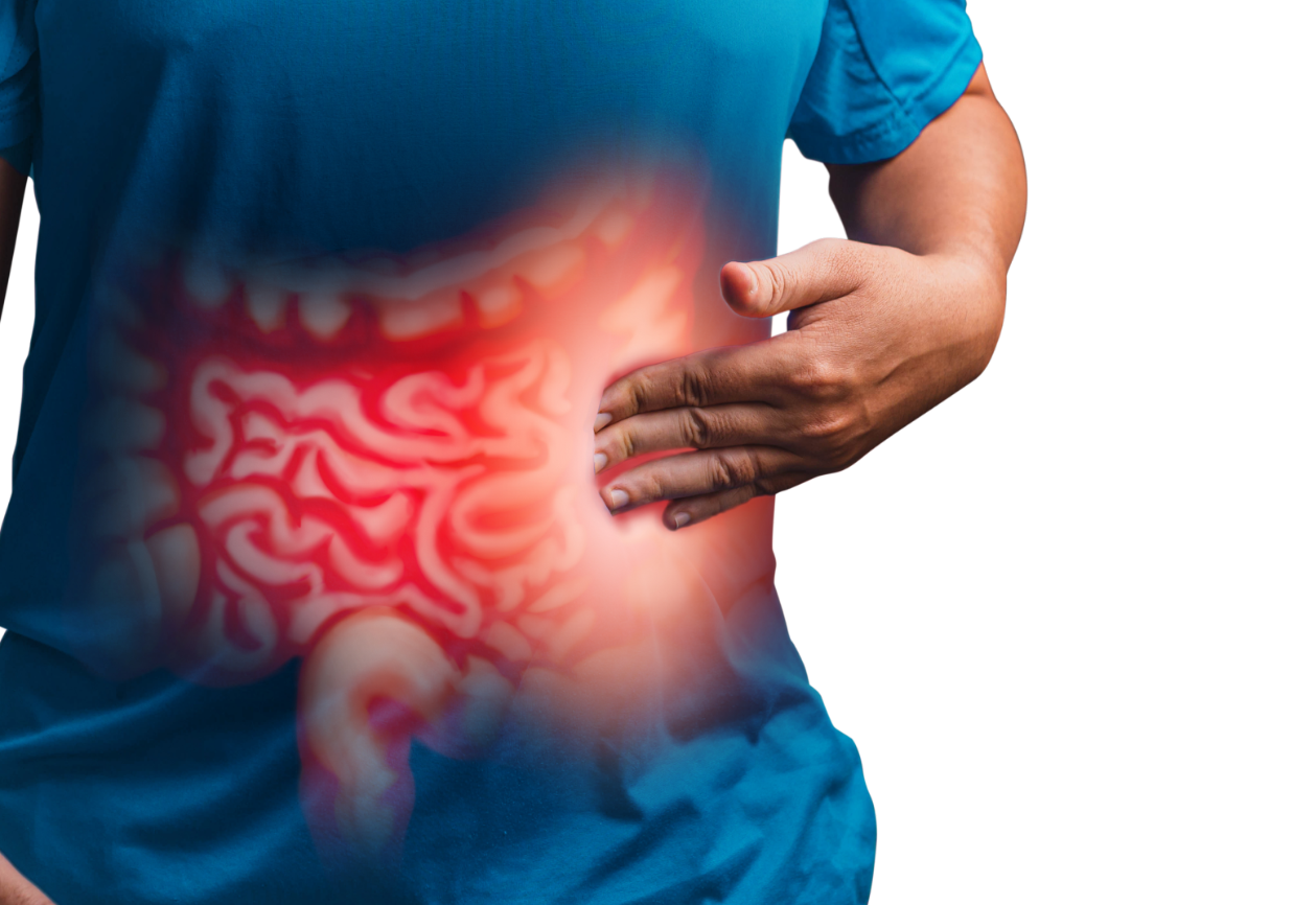 What is Gastrointestinal GI Surgery