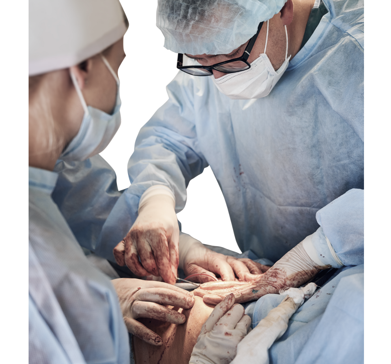Procedure of Liver Transplant Surgery