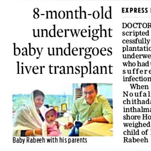 8 Month Baby Liver Transplant PDF