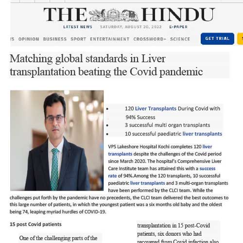 Matching Global Standards in Liver Tranplantation PDF