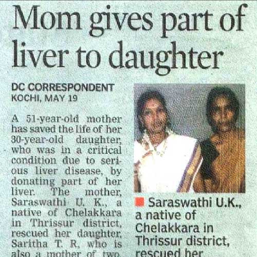Mom gives part of liver to daughter PDF